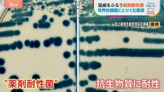 薬が効かなくなる“薬剤耐性菌”2050年には世界で年間1000万人超死亡のおそれが… 世界的課題に取り組む医師　“抗菌薬の適正使用と感染対策”|TBS NEWS DIG