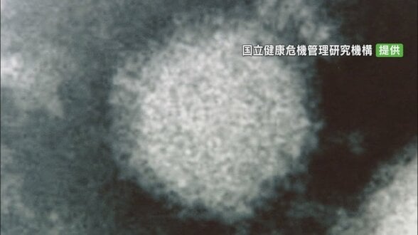 SFTS=重症熱性血小板減少症候群の患者 山梨で初の確認 予防のポイント | 山梨のニュース | UTYテレビ山梨