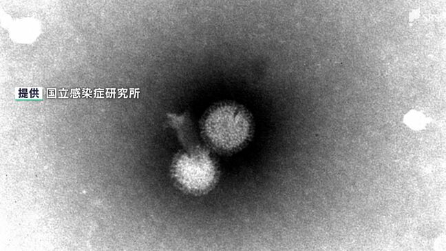 「薬が徐々に足りなくなってきている」猛威振るうインフルエンザ… 新型コロナとの“同時流行”懸念|TBS NEWS DIG