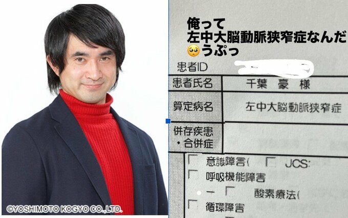 【 千葉ゴウ 】脳梗塞で倒れ失語症になった40歳芸人　自身のカルテを公開「俺って左中大脳動脈狭窄症なんだ　うぷっ」|TBS NEWS DIG