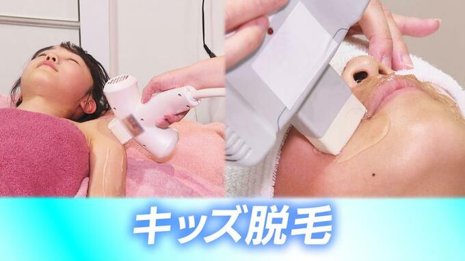 “体毛の悩み”は今や小学生から…８割以上の子どもが気にしている！？いま小中学生に増える“キッズ脱毛”の現場　低年齢化する美意識と、わが子の悩みを解消したい親心も|TBS NEWS DIG