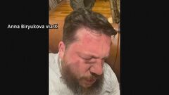 ナワリヌイ氏陣営幹部襲撃 “ロシアが計画の可能性” リトアニア情報当局| TBS CROSS DIG with Bloomberg