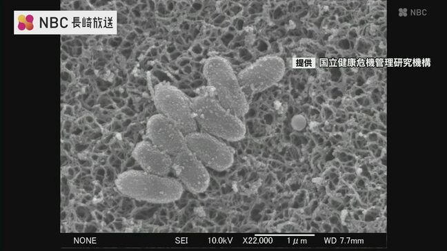 激しいせきが続く「百日せき」 一週間の報告数が2018年以降最多に 乳児は重症化の恐れも【長崎】|TBS NEWS DIG