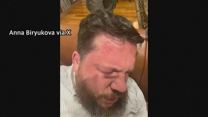 ナワリヌイ氏陣営幹部襲撃 “ロシアが計画の可能性” リトアニア情報当局