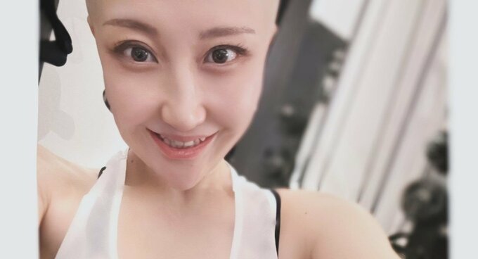 【がん闘病】西丸優子さん（４３）　抗がん剤投与の副作用を報告　「口内炎と手足の痺れ、頭がピリピリ痛い」|TBS NEWS DIG
