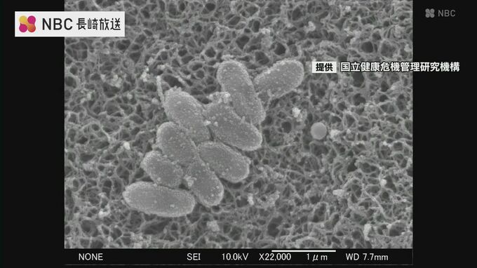 激しいせきが続く「百日せき」 一週間の報告数が2018年以降最多に　乳児は重症化の恐れも【長崎】|TBS NEWS DIG
