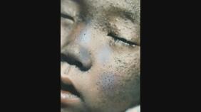 「地獄の底に突き落とした」PCB製造会社は沈黙　黒い赤ちゃんから57年　終わらないカネミ油症の苦しみ|TBS NEWS DIG