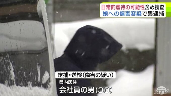 娘の腕をライターの火であぶってやけどを負わせた傷害の疑いで逮捕の30歳の父親を送検　警察は日常的な虐待の可能性含め捜査進める　青森県|TBS NEWS DIG