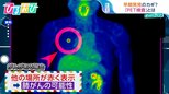 早期発見のカギ?がん検診に「PET検査」 専門医に聞くメリット・デメリット【ひるおび】|TBS NEWS DIG