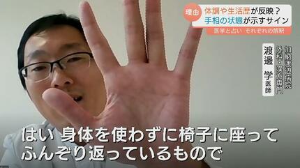 手相が変わる」ってホント？ 運勢をみるだけじゃない！手相が示す健康