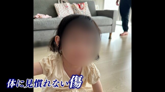 「何回も言うけどくさい」「ご迷惑かけてんのよあんたは」保育士が2歳児に投げた言葉　暴言、暴力認める　発覚のきっかけは”お守りに忍ばせたボイスレコーダー”|TBS NEWS DIG
