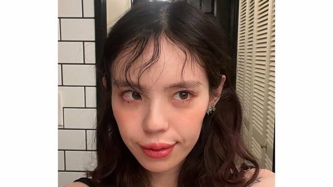 難病【脊髄小脳変性症】 瀬戸あゆみさん 「32歳になったよ、1ヶ月と11日前に。(更新遅っ)」「そんな気持ちで、また日々がんばります!」 最新ショットを公開|TBS NEWS DIG