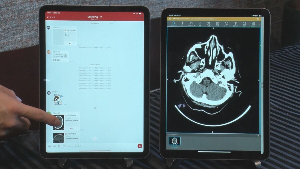 CTやMRI画像をスマホで共有　医療関係者専用アプリ「Join」　沖縄本島北部・離島でも救急時の治療までの時間短縮へ