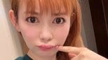 【中川翔子】「体調悪いとなるクインケ浮腫」「くちびるが腫れてしまった」痛々しい画像を投稿|TBS NEWS DIG