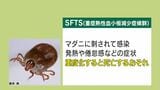 マダニ媒介のSFTSに70代女性が感染 今年鹿児島県内初 | 鹿児島のニュース|MBC NEWS|南日本放送
