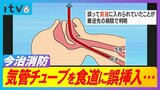 心肺停止状態の男性 救急救命士が気管チューブを食道に誤挿入 手順に定められた確認怠る 男性はその後死亡「死亡との因果関係はない」今治消防 | 愛媛のニュース - Nスタえひめ|あいテレビは6チャンネル