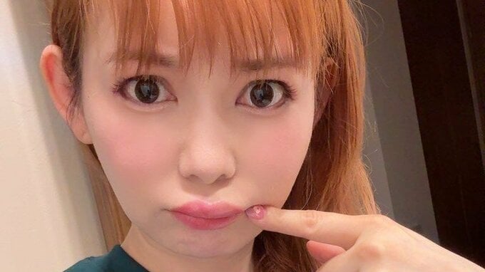【中川翔子】「体調悪いとなるクインケ浮腫」「くちびるが腫れてしまった」痛々しい画像を投稿|TBS NEWS DIG