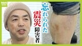 震災で「家具の下敷きになり右脚切断」の男性　見舞金の支給に高い壁「対象が重度すぎて...右脚レベルはどうでもいいの？」進まない「震災障害者」への調査と支援「『わがこと』として捉えて」|TBS NEWS DIG