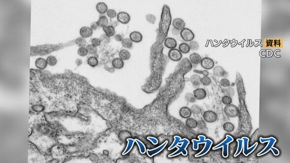 ｢コロナみたいになったら怖い｣ ハンタウイルスの疑問…感染力は？特効薬は？医師に聞いてみた 大西洋を航行していたクルーズ船で感染相次ぐ　|　名古屋・愛知・岐阜・三重のニュース【CBC news】 | CBC web
