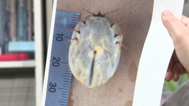 西日本中心に“マダニ”に注意 住宅街の茂みでパンパンに膨らんだマダニも…マダニが媒介する致死率10%超えの感染症SFTSとは?50歳以上は特に重症化しやすいか|TBS NEWS DIG