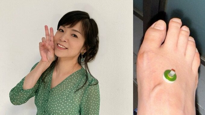 【 石原詢子 】放射線治療が折り返しに　「今は上手に付き合うしかないですね・・」足の浮腫対策を明かす|TBS NEWS DIG