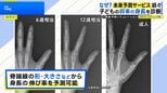 将来の「身長」から「視力」、「病気のリスク」まで…広がる“未来予測サービス”【THE TIME,】|TBS NEWS DIG