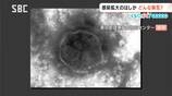 はしかの感染が拡大　【くらピタ！】　麻しんウイルスによる感染症　主に39度以上の発熱、咳・鼻水、全身の発しんなどの症状　「ワクチン空白世代」とは？　|　SBC NEWS | 長野のニュース | SBC信越放送