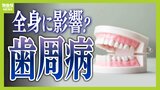 歯磨き後は『すすぎ不要』口腔ケアの新常識⁉　45歳以上の2人に1人は歯周病「唾が間違って肺に入ったら、あっという間に肺炎」全身に影響する可能性|TBS NEWS DIG