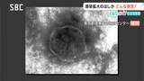 はしかの感染が拡大　【くらピタ！】　麻しんウイルスによる感染症　主に39度以上の発熱、咳・鼻水、全身の発しんなどの症状　「ワクチン空白世代」とは？|TBS NEWS DIG