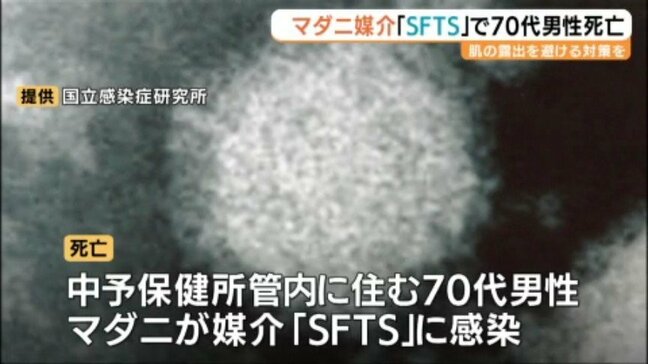 マダニ媒介のウイルス「SFTS」で70代男性が死亡　愛媛県内で今年初の死亡例|TBS NEWS DIG