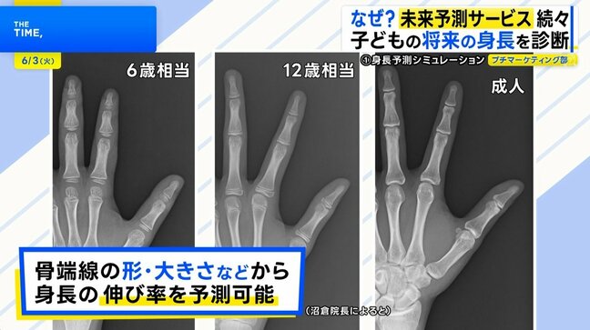 将来の「身長」から「視力」、「病気のリスク」まで…広がる“未来予測サービス”【THE TIME,】|TBS NEWS DIG