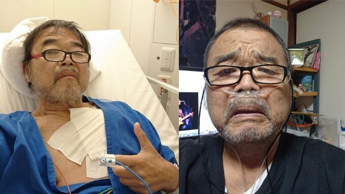 【グレート義太夫さん 死去】糖尿病や心筋梗塞　自身の闘病をユーモア交え伝え続けた　最後の投稿は亡くなった当日|TBS NEWS DIG