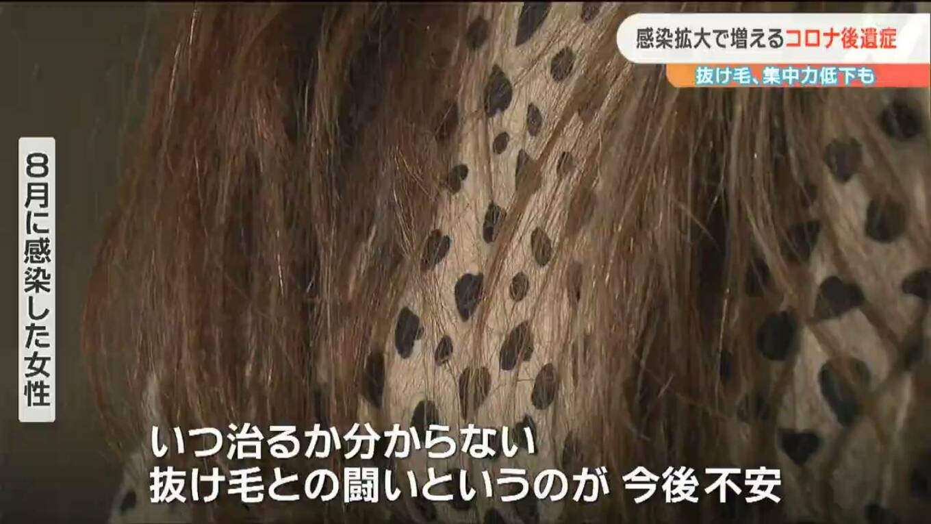 「いつ治るか分からない抜け毛との闘い」増える新型コロナ後遺症“感染者が訴えるその症状は？ | TBS NEWS DIG (2ページ)