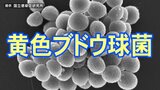吉田屋の弁当を食べて数時間後に激しい嘔吐 「ベッドに入ったらすぐ吐き気」 体調不良の女性証言　食中毒に家庭での対策は　|　RCC NEWS | 広島ニュース | RCC中国放送