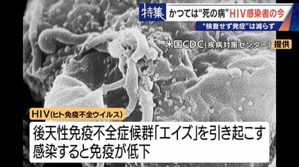かつて｢死の病｣と呼ばれ…20年前HIVに感染した男性の今 1日2粒で“普通の
