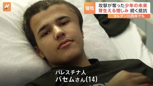 「死んだ方がましだった」14歳少年が抱く憎しみの芽　爆撃で脳に障害　増え続ける犠牲者 パレスチナ ヨルダン川西岸|TBS NEWS DIG