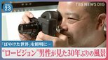 レーザー網膜投影カメラで「ぼやけた世界」を鮮明に…難病で視力低下の“ロービジョン”男性が見た30年ぶりの風景【news23】|TBS NEWS DIG