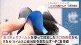 あぶらとりフィルムでネコの皮脂から「SFTS」感染を確認 宮崎大学などの研究グループ | MRTニュース | MRT宮崎放送
