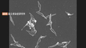 「マイコプラズマ肺炎」が過去最多　5週連続増加で1医療機関あたりの患者数「1.64人」　今後さらに感染広がる可能性も|TBS NEWS DIG