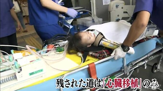 選択の医療「臓器移植」を考える　移植法施行25年・国内の現状は|TBS NEWS DIG