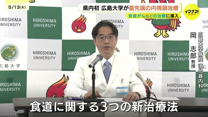 「身体の負担少なく、保険も適用！食道疾患治療の選択肢に」県内初の最先端内視鏡治療　広島大学が導入　|TBS NEWS DIG