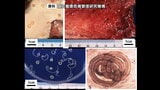 アニサキス食中毒サンマやイカの刺身食べた30代客が腹痛 飲食店を1日間の一部営業停止 宮城|TBS NEWS DIG