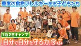『重度の食物アレルギー』で旅行やお祭り楽しめない子どもたちが...医師も帯同「お泊りキャンプ」挑戦で『自分で自分を守る』を学ぶ|TBS NEWS DIG