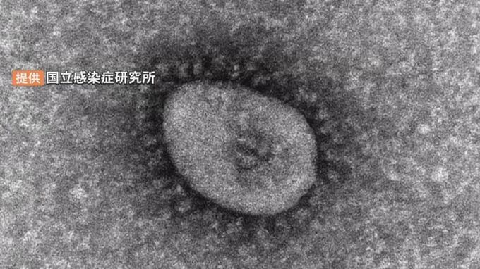 【新型コロナ】鳥取県で感染者１人の死亡確認 累計２５５人に|TBS NEWS DIG