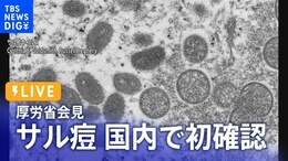 【LIVE】“サル痘”国内で初確認 厚労省が緊急会見|TBS NEWS DIG