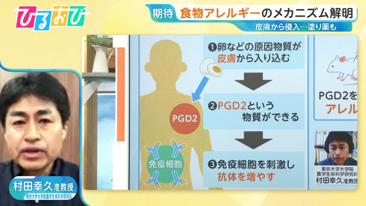 肌から体内へ「食物アレルギー」メカニズム初解明 “塗り薬”で予防も