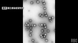 デング熱患者ことし沖縄県内2例目 東南アジア帰国後に40度の発熱 | 沖縄のニュース|RBC 琉球放送