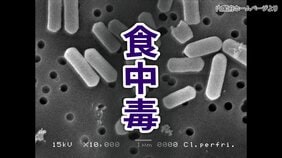宿泊施設で97人に腹痛や下痢などの症状　ウエルシュ菌による集団食中毒と断定　食事を提供した飲食店業者に営業禁止処分　広島・福山市|TBS NEWS DIG