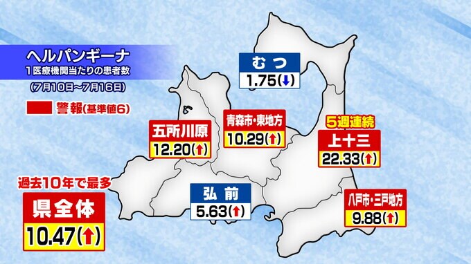 過去10年で最多　ヘルパンギーナ流行　４保健所管内の警報継続　青森県|TBS NEWS DIG
