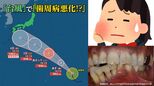 【台風情報】「台風で歯周病悪化」との情報が なぜ&どうすればいい??教授に電話してみると【進路予想を気にしながら...】|TBS NEWS DIG